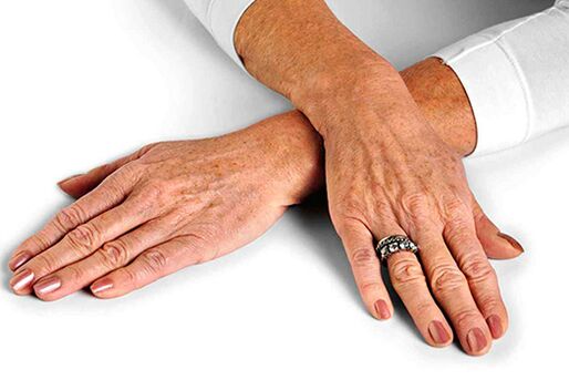 若返り技術の使用を必要とする加齢に伴う変化を伴う手の皮膚